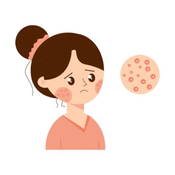 Как акне отражает внутренний мир: психотерапия и восстановление связи с собой